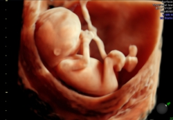 hdlive_baby2_still.jpg