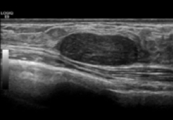 ultrasound-for-diagnostic-oncology-232.jpg